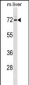 FXR1 Antibody (N-term)